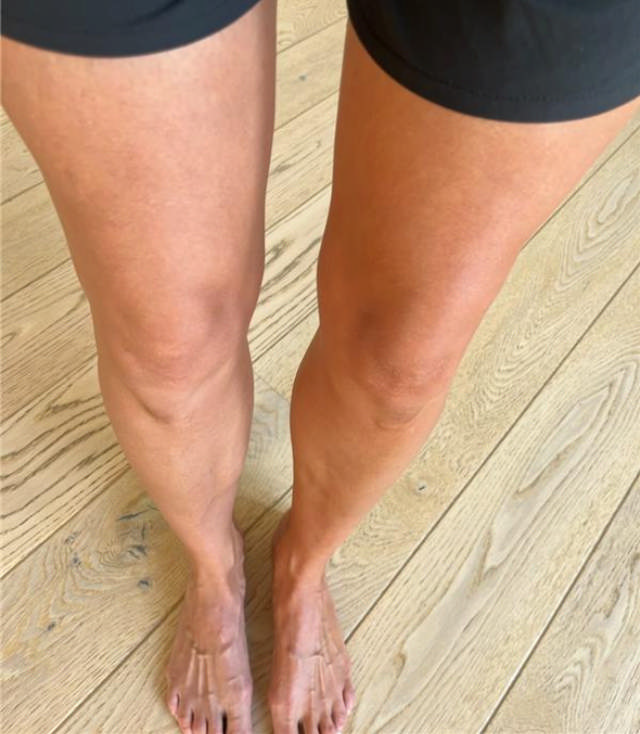 Vita Liberata Clear Tanning Mousse Medium, 200 ml